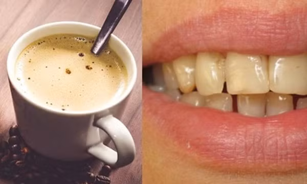 Cách uống cà phê giúp bảo vệ răng miệng