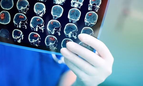 Sự bùng nổ của AI sẽ tạo ra đột phá cho chẩn đoán, điều trị ung thư