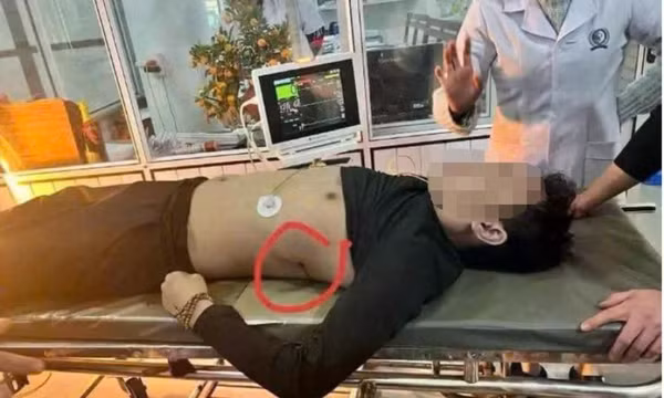 Bắt giữ nghi phạm nổ súng bắn chết người ở Hà Tĩnh