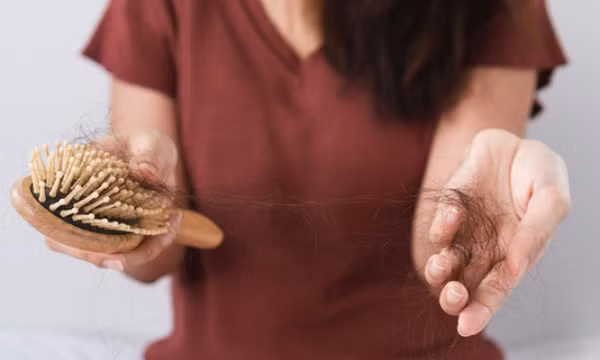 Lý do người từng nhiễm Covid-19 bị rụng tóc nhiều không tưởng