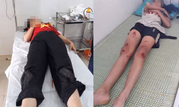 Xe đạp điện lao xuống suối, ba học sinh lớp 7 thương vong
