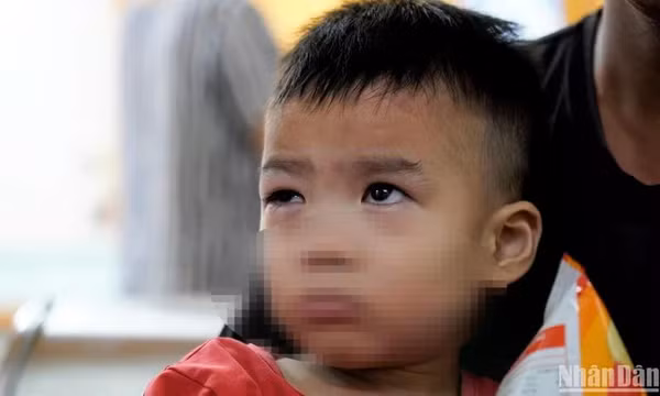 Xử lý nghiêm việc lợi dụng dịch bệnh đau mắt để tăng giá thuốc