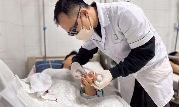 Pháo nổ khiến 141 người phải nhập viện sau 4 ngày nghỉ Tết