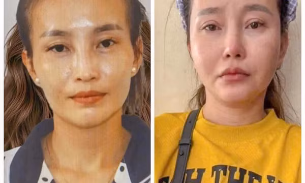 Phẫu thuật thẩm mỹ để trốn truy nã nhưng vẫn bị bắt