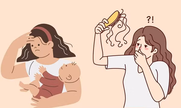 3 sai lầm phổ biến gây rụng tóc ở phụ nữ sau sinh