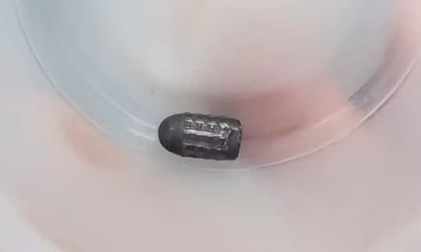 Đã tìm ra người bắn súng hơi khiến đạn lạc trúng đầu người phụ nữ làm vườn