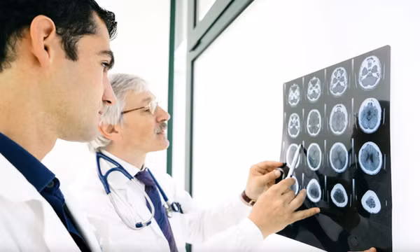 Hút thuốc làm teo não và tăng nguy cơ mắc bệnh Alzheimer