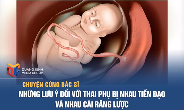 Những lưu ý đối với thai phụ bị nhau tiền đạo và nhau cài răng lược
