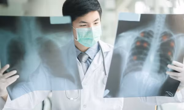 Ung thư di căn vị trí nào đáng sợ nhất?