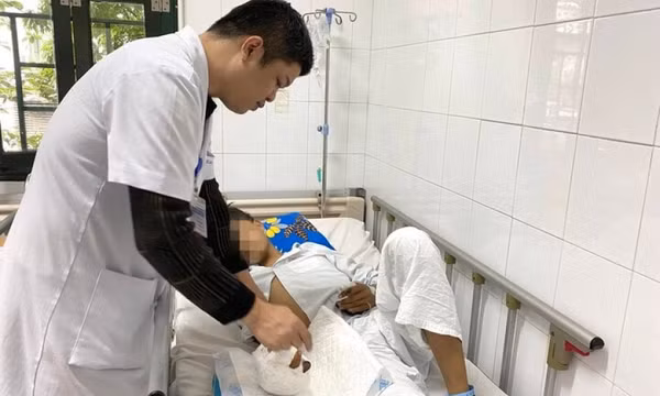 Chơi pháo tự chế, 3 thiếu niên bị nổ nát tay