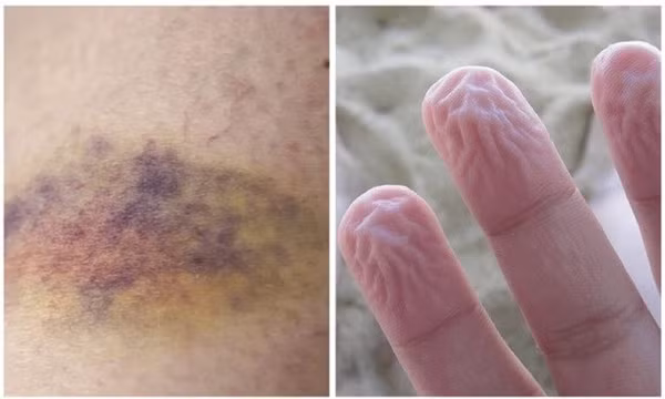6 dấu hiệu cơ thể cảnh báo các vấn đề về sức khoẻ