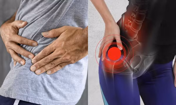 Triệu chứng các giai đoạn của bệnh thoái hóa khớp hông