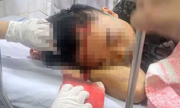 Tạm giữ 14 người vụ 2 nhóm trai làng ở Hải Phòng hỗn chiến