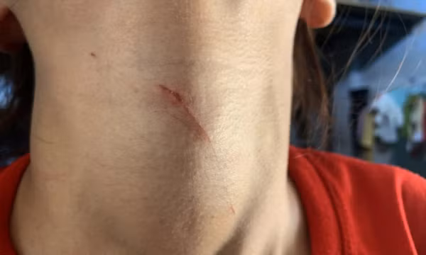 Bắt đối tượng kề dao khống chế cô gái trẻ để cướp đôi bông tai