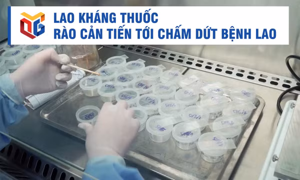 Lao kháng thuốc – rào cản tiến tới chấm dứt bệnh lao