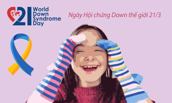 Hội chứng Down: Những điều cần biết