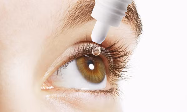 Các phương pháp trị viêm bờ mi mắt