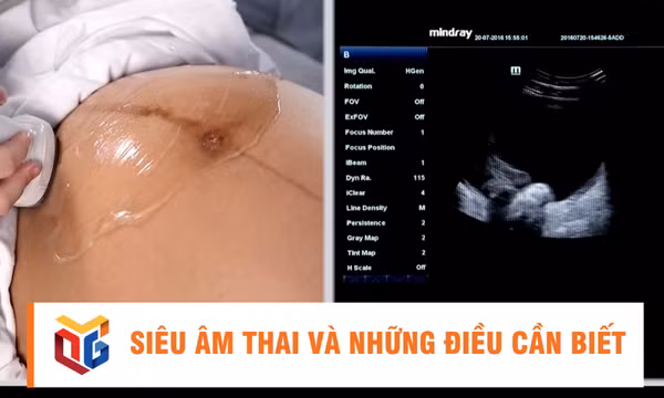 Siêu âm thai và những điều cần biết