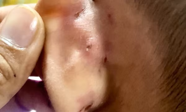 Khởi tố cô giáo mầm non nhiều lần bạo hành trẻ ở Kiên Giang