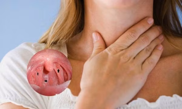 Ung thư vòm họng: Dấu hiệu nhận biết và cách tầm soát