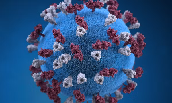 Virus sởi đột biến có thể gây bệnh viêm não