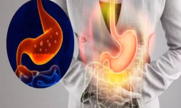 6 biện pháp tại nhà khắc phục chứng trào ngược axit dạ dày vào buổi sáng