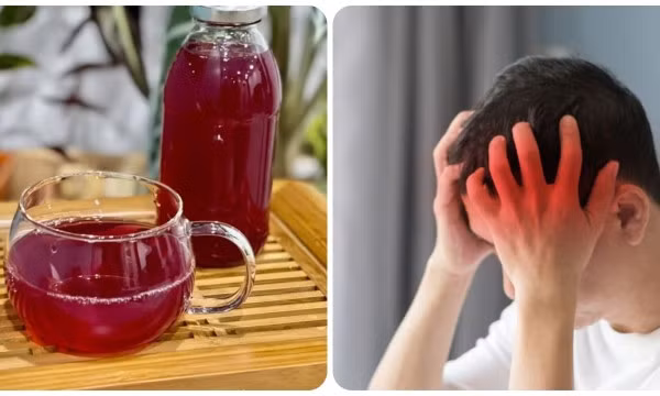 Ai không nên uống nước lá tía tô?