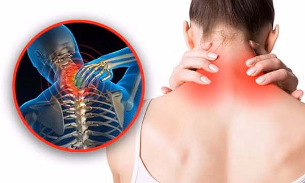 Cách massage cổ đơn giản giúp giảm đau đầu, chóng mặt