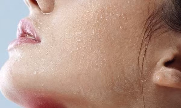Thói quen xấu khiến da khô bong tróc trong mùa đông