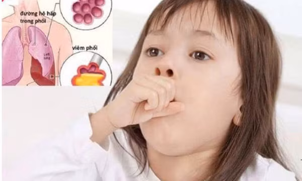 6 cách bảo vệ trẻ không bị ốm khi trời trở lạnh
