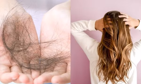 Bác sĩ da liễu lý giải nguyên nhân tóc thường gãy rụng mùa lạnh