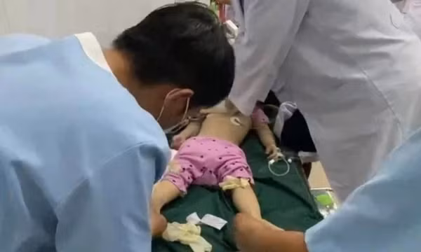 Từ vụ bé 3 tuổi tử vong vì sặc thức ăn ở nhà trẻ, bác sĩ nêu cách xử trí đúng ngay tại chỗ