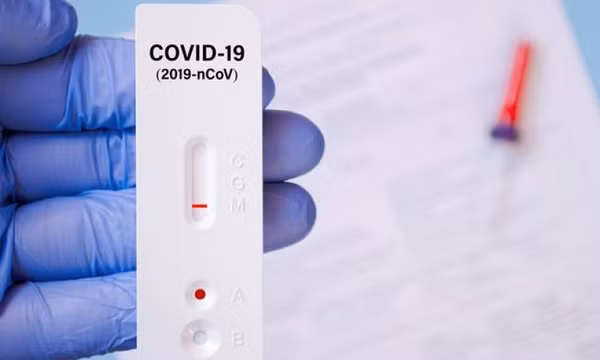 Kiểm tra việc kinh doanh, mua bán test xét nghiệm COVID-19 của cơ sở kinh doanh kit, test xét nghiệm COVID-19