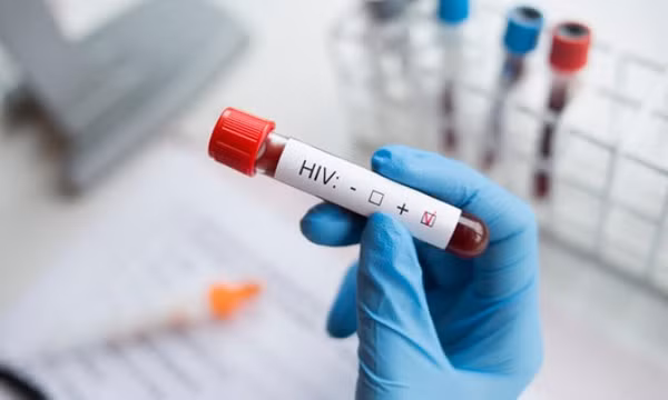Người phụ nữ đầu tiên khỏi nhiễm HIV sau khi được ghép tế bào gốc