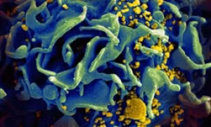 Ghi nhận biến thể mới của virus HIV tại Hà Lan
