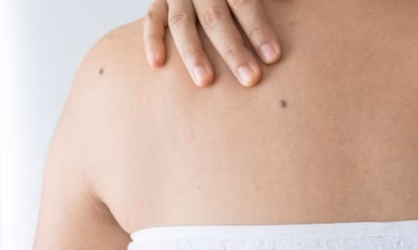 Những dấu hiệu phổ biến cảnh báo ung thư