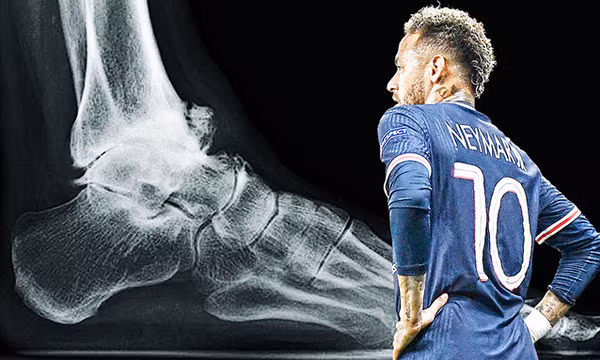 Neymar nghỉ thi đấu 8 tuần vì tổn thương dây chằng mắt cá chân