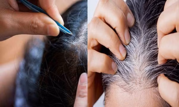 Tác hại của việc nhổ tóc bạc thường xuyên