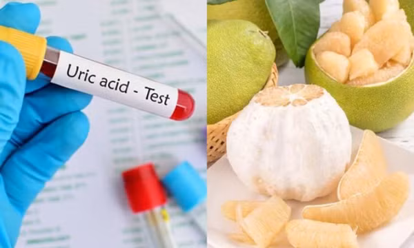 Tác dụng của ăn bưởi tới người có chỉ số axit uric cao