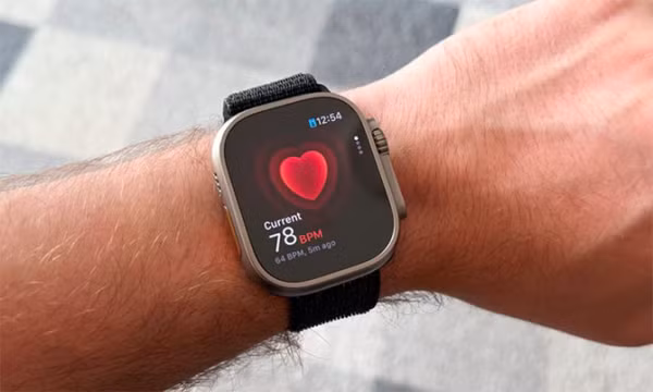 Apple Watch X sẽ có theo dõi huyết áp