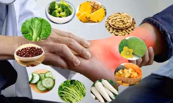 Tác động của thức ăn đến người có axit uric cao, bệnh gout