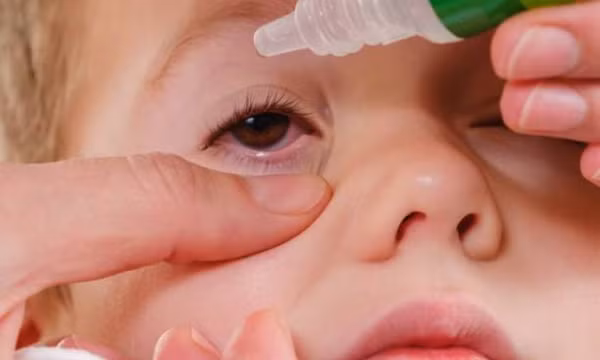 Sử dụng thuốc nhỏ mắt ở trẻ em đúng cách tại nhà