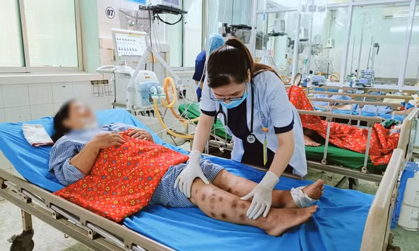 Tự tiêm canxi, nữ bệnh nhân xuất hiện chi chít nốt hoại tử ở tay chân