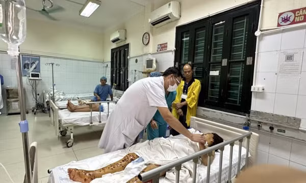 Nổ điện thoại khi sạc, người phụ nữ bị vỡ nhãn cầu và cụt ngón tay