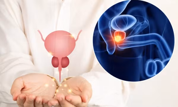 Khi nào nam giới nên tầm soát ung thư tuyến tiền liệt?