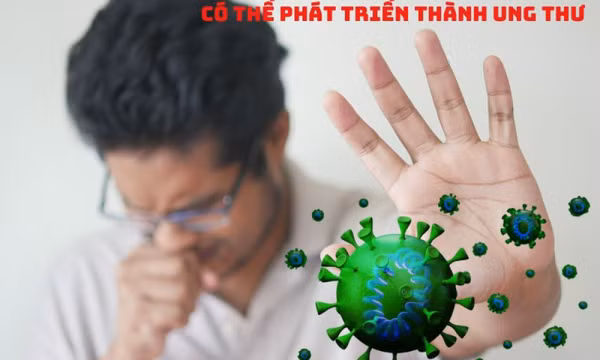 5 bệnh viêm nhiễm phổ biến có thể phát triển thành ung thư