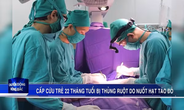 Cấp cứu trẻ 22 tháng tuổi bị thủng ruột do nuốt hạt táo đỏ