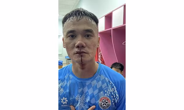 Cầu thủ hạng Nhất đánh nhau trong đường hầm sân Thống Nhất