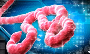 Đã có người nghi nhiễm virus Ebola tại Australia