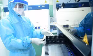 Xét nghiệm COVID-19 với phóng viên đưa tin tại Đại hội XIII của Đảng